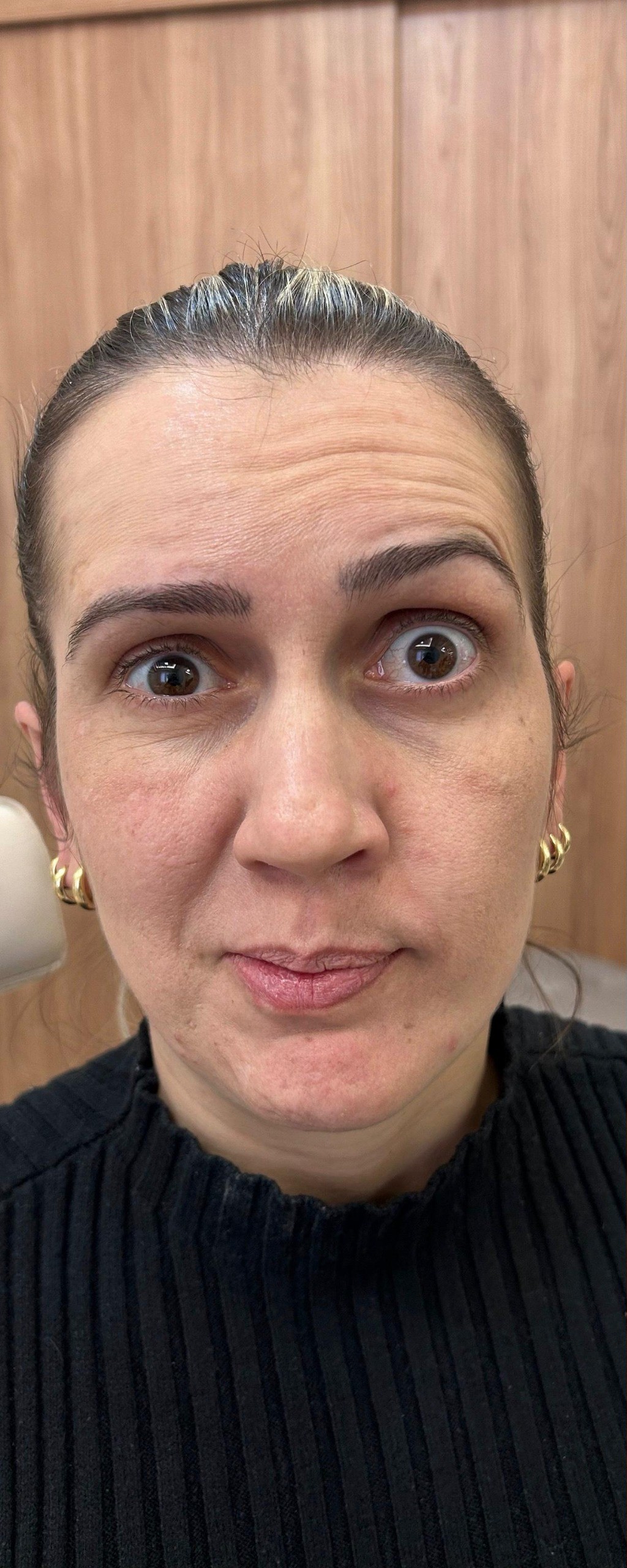 Full Face - antes, caso 2