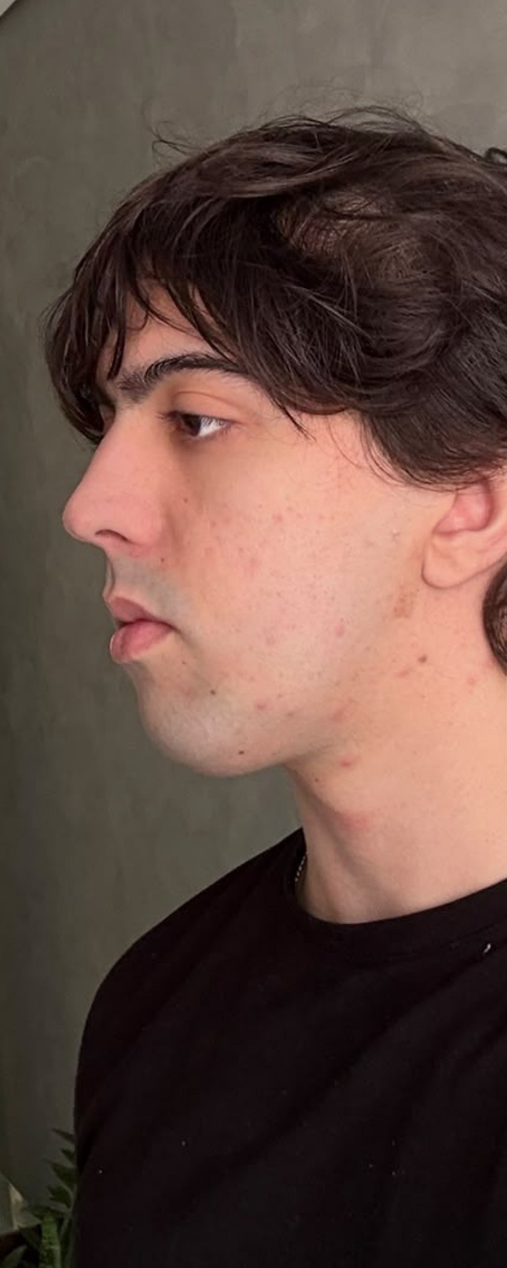 Full Face - antes, caso 5