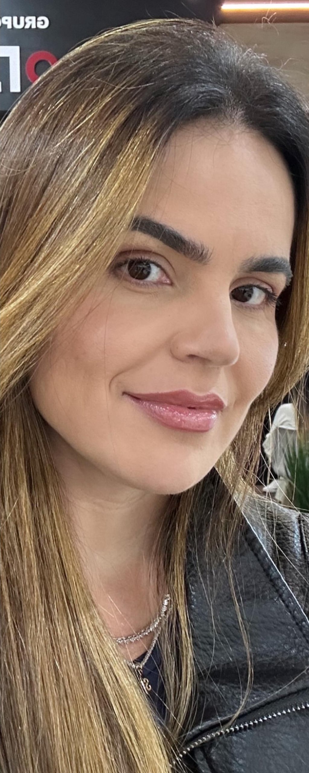 Full Face - depois, caso 6