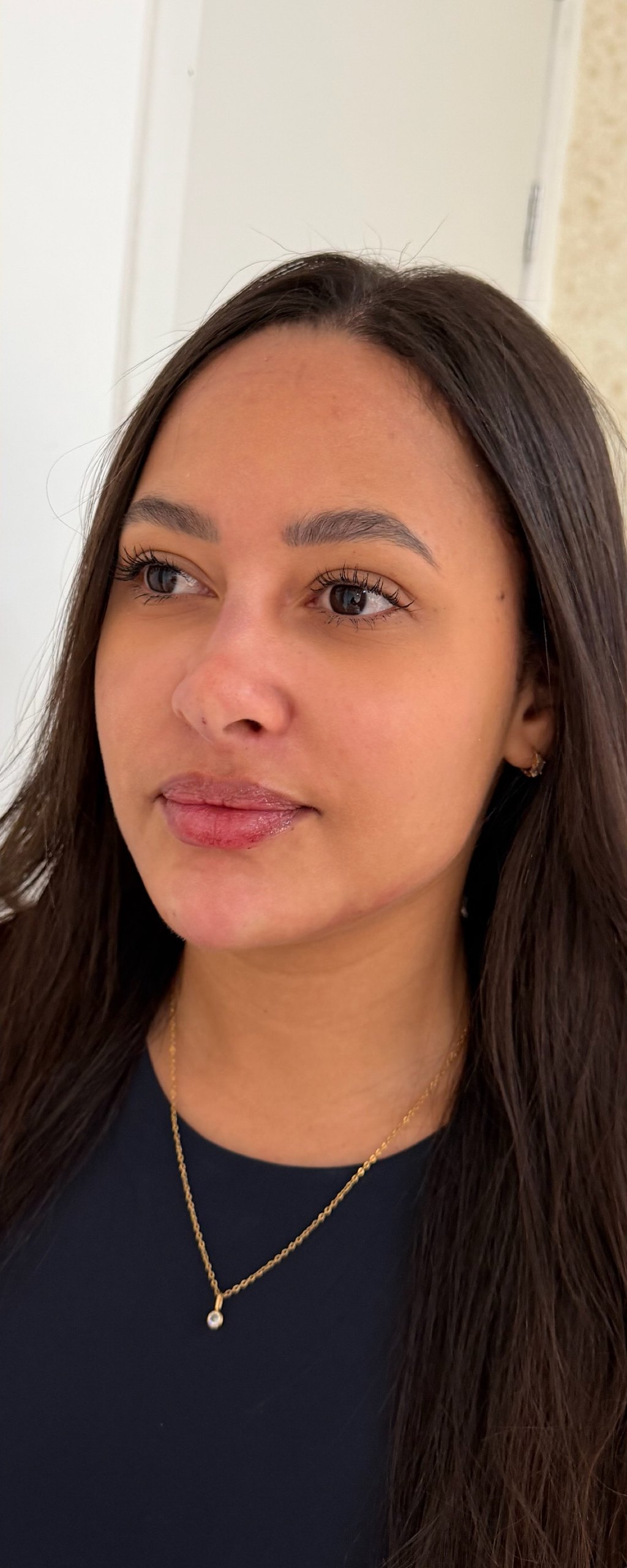 Full Face - depois, caso 7