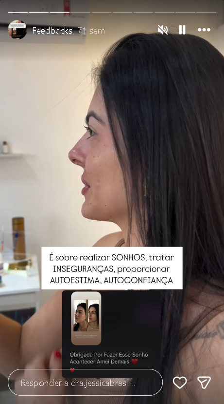 Print de conversa - depoimento real de paciente